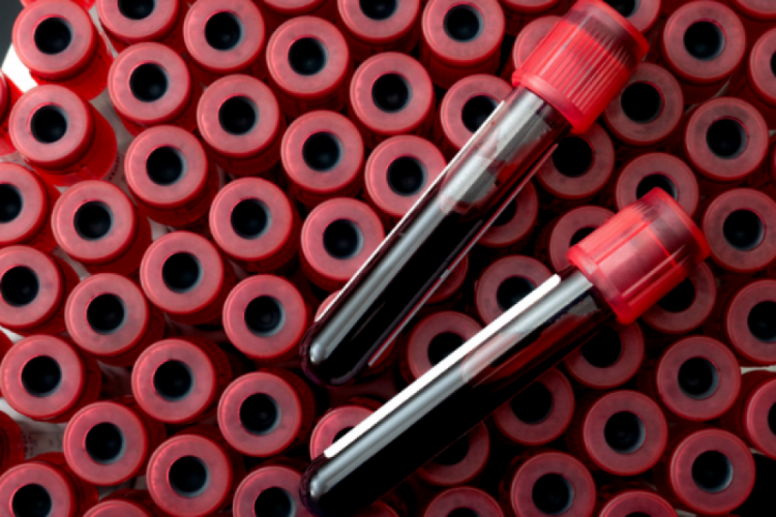 Rádio Vizela - Pode doar sangue até às 12H30 de hoje